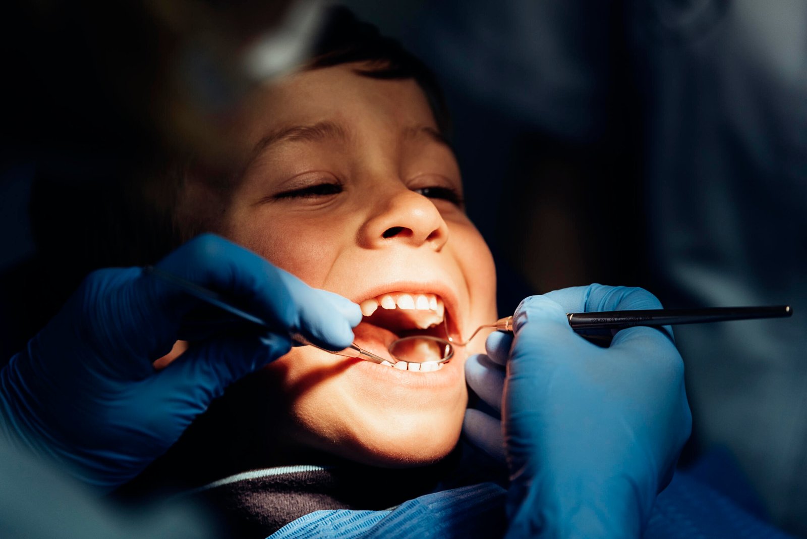 Tooth Extraction (Simple & Surgical)