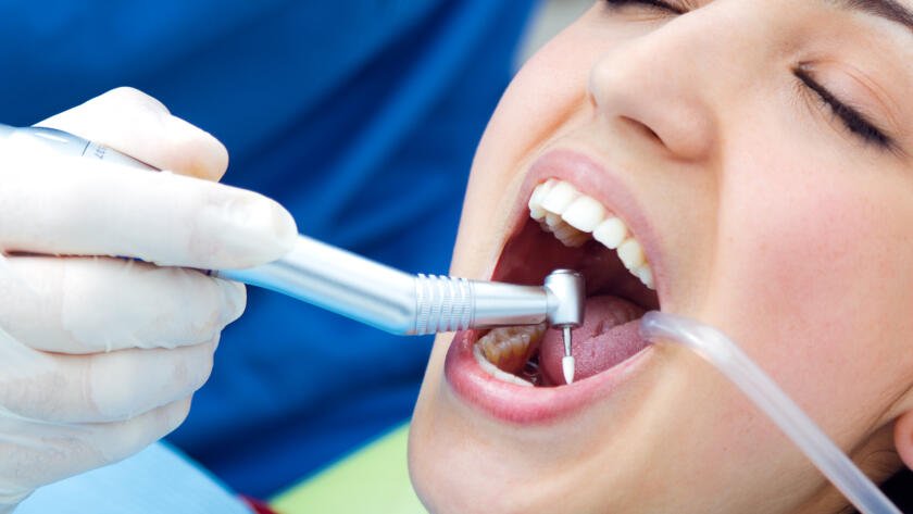 tooth extraction