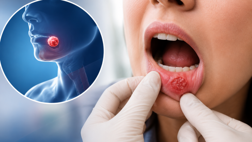5 warning signs of oral cancer