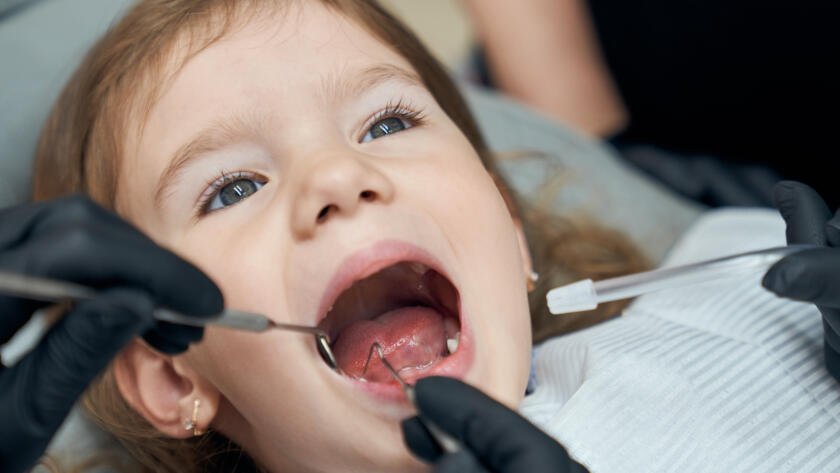 Tooth Decay in Children