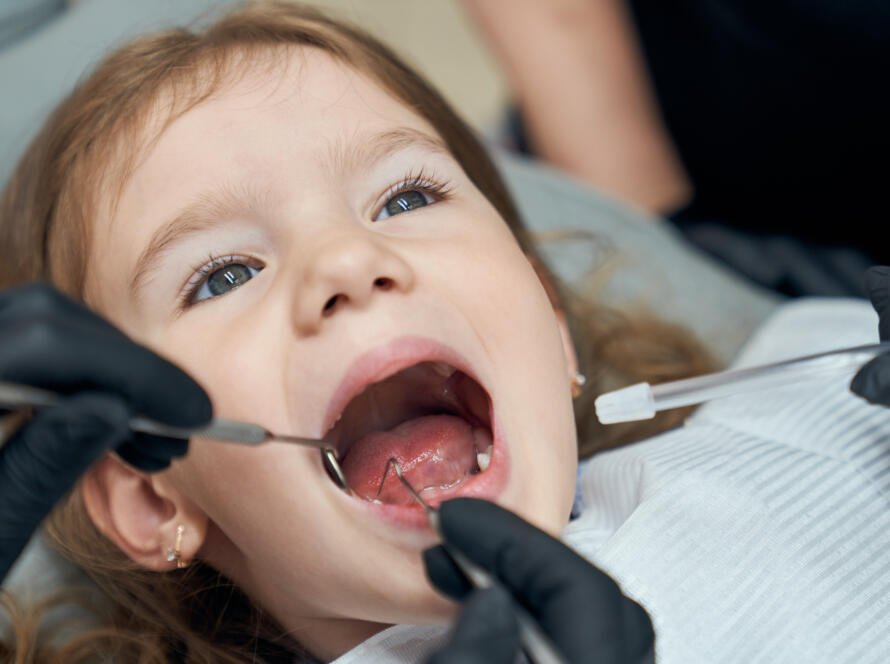 Tooth Decay in Children